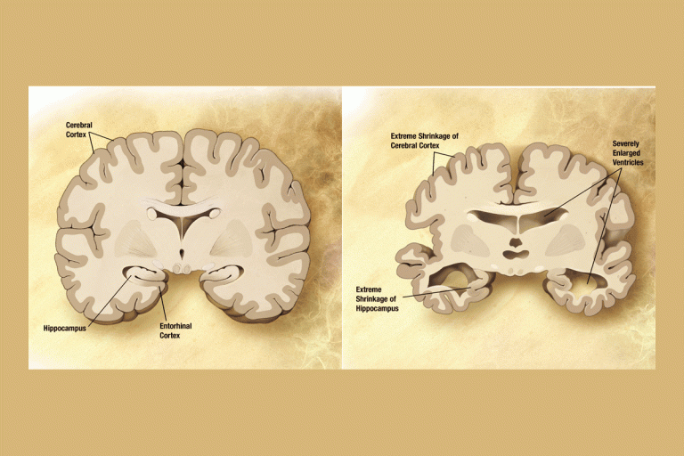 Ricoh apoia projeto pioneiro na luta contra o Alzheimer da Misericórdia de Gaia